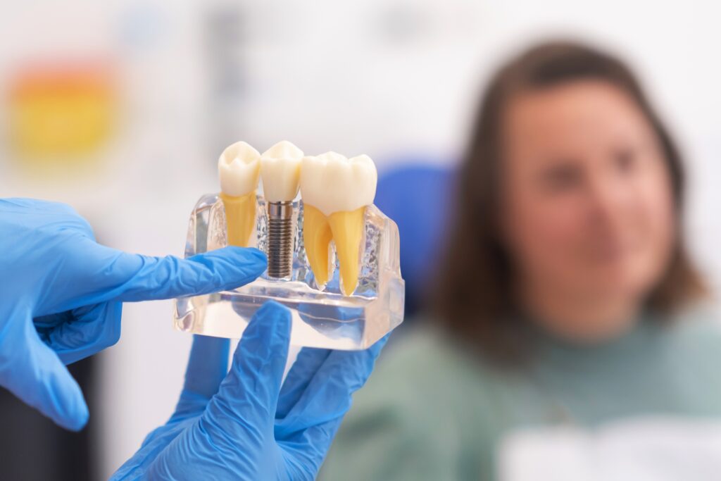 dental implants Manlius